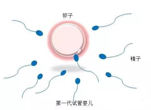 男性因素案例